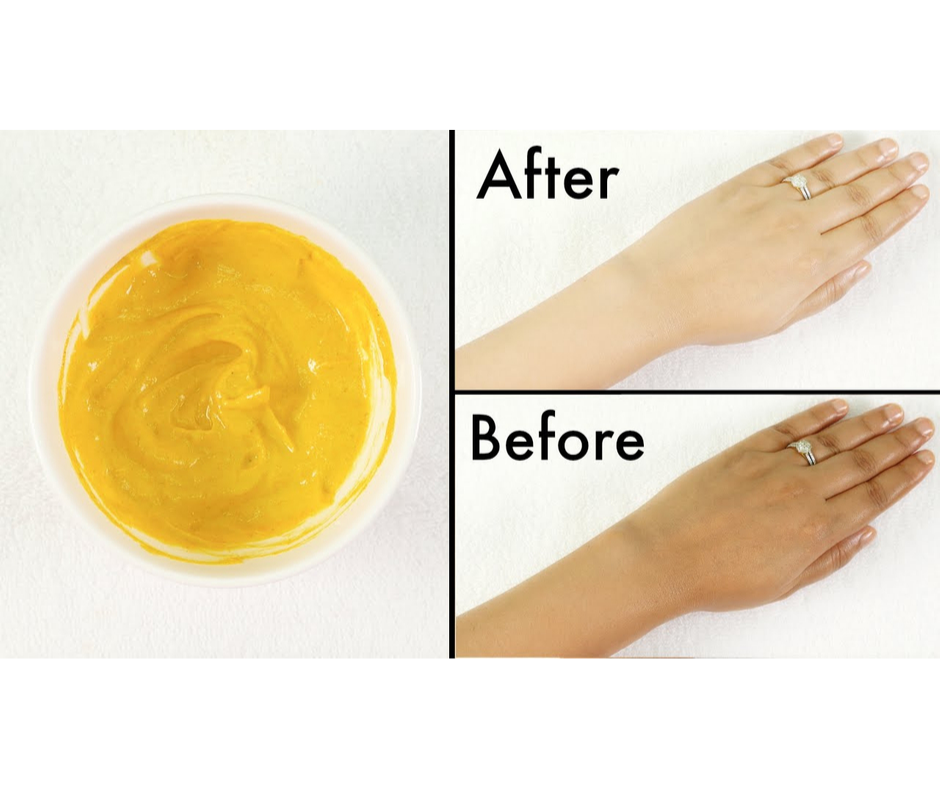HOMEMADE MASK TO REMOVE SUNTAN