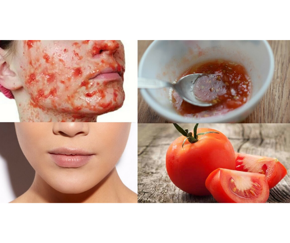 DIY TOMATO FACIAL FOR GLOWING SKIN