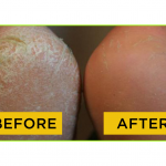 DIY SKINCARE MASK FOR CRACKED HEELS