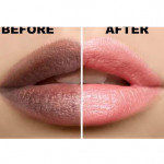DIY REMEDY FOR DARK LIPS