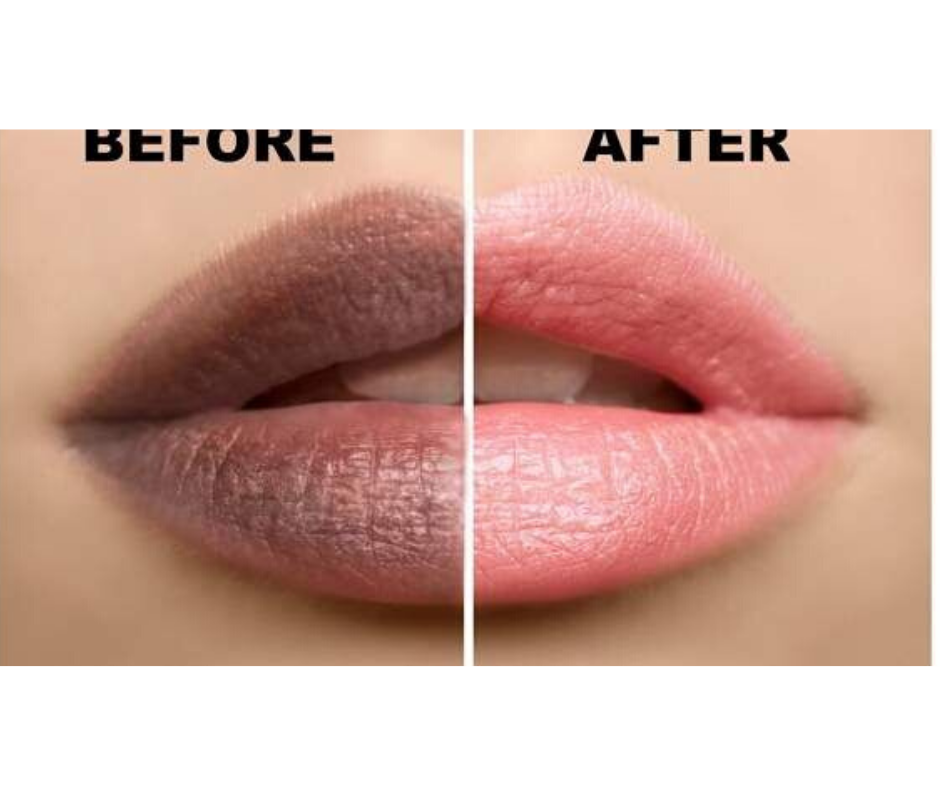 DIY REMEDY FOR DARK LIPS V Beautify