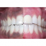 DIY ORAL CARE MASK FOR CLEAN GUMS