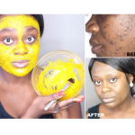 DIY TURMERIC MASK FOR SKIN