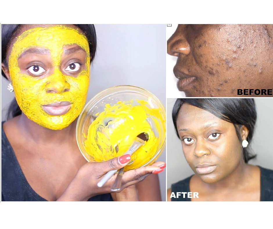 DIY TURMERIC MASK FOR SKIN