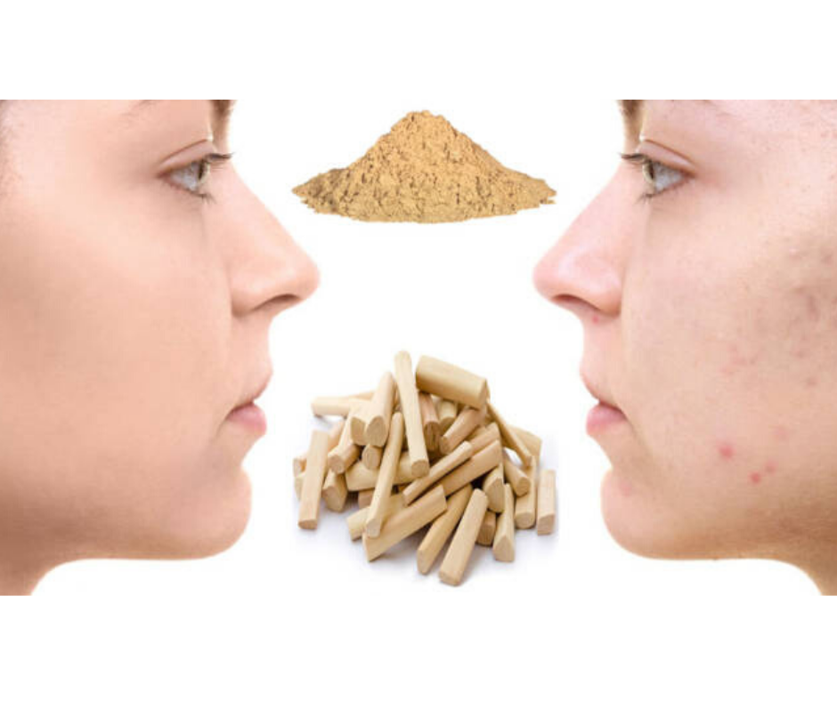 DIY SANDALWOOD FACE MASK FOR SKIN