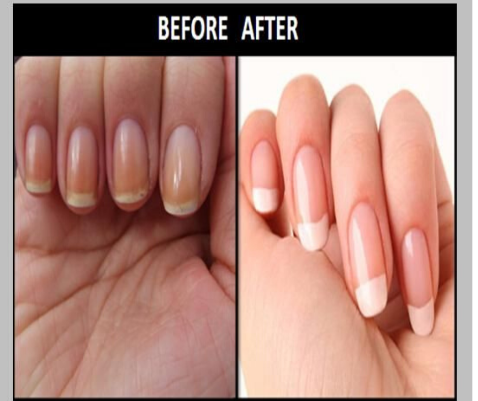 HOW TO GET RID OF YELLOW NAILS