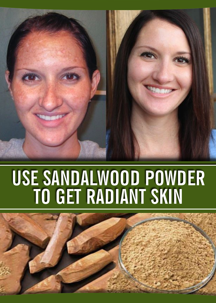 Use Sandalwood Powder To Get Radiant Skin