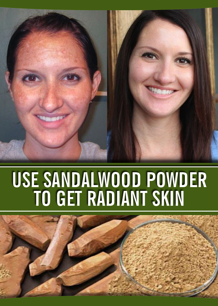 USE SANDALWOOD POWDER TO GET RADIANT SKIN the-health-benefits-of-sandalwood