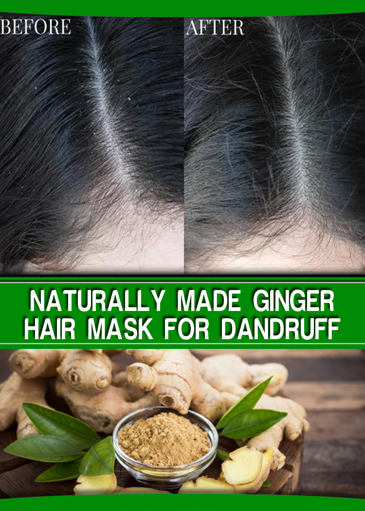 NATURALLY MADE GINGER HAIR MASK FOR DANDRUFF