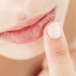 DIY REMEDIES FOR CHAPPED LIPS