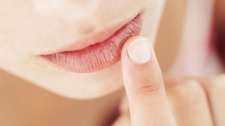 DIY REMEDIES FOR CHAPPED LIPS