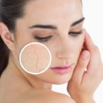 DIY MASK FOR FLAKY AND DRY SKIN