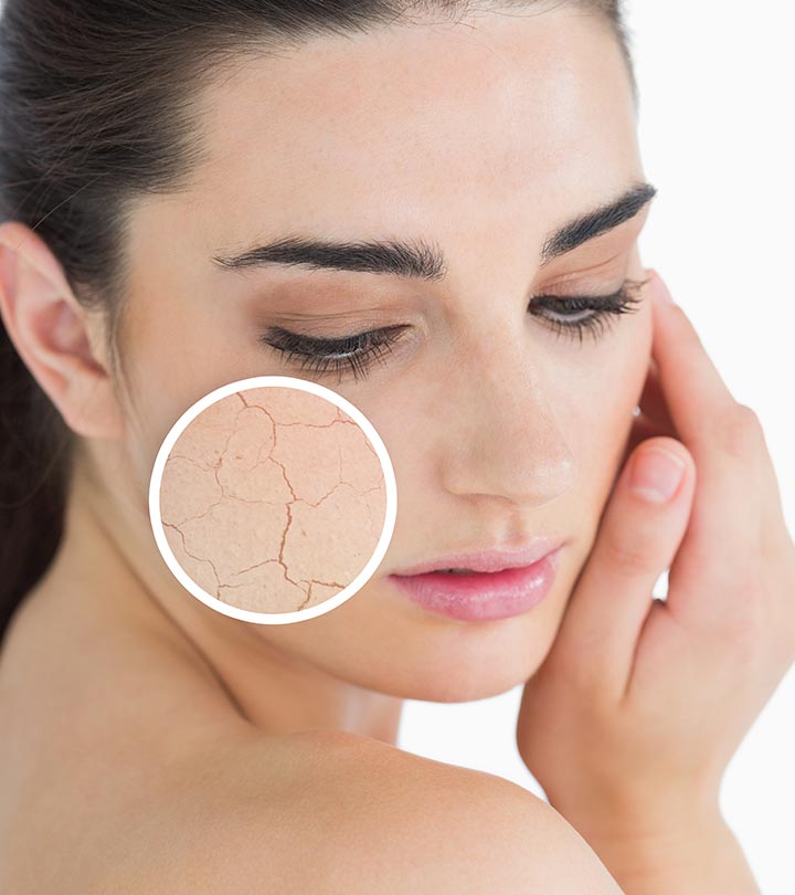 DIY MASK FOR FLAKY AND DRY SKIN