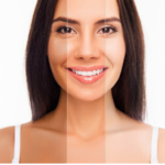 DIY MASK FOR SUN TAN AND DULL SKIN