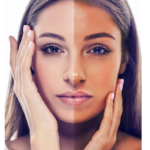 DIY ANTI-TAN MASK FOR ALL SKIN TYPES