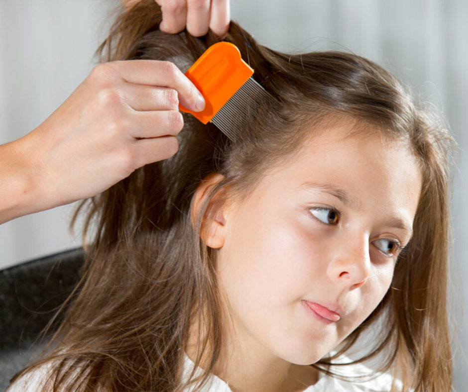 DIY HAIR CARE MASK FOR LICE AND NITS.