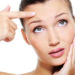 REMOVE FINE LINES ON SKIN IN JUST A MONTH
