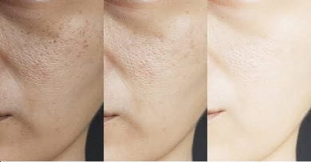 Natural Remedies for Brightening Up Our Dull Skin