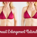 BREAST ENLARGEMENT