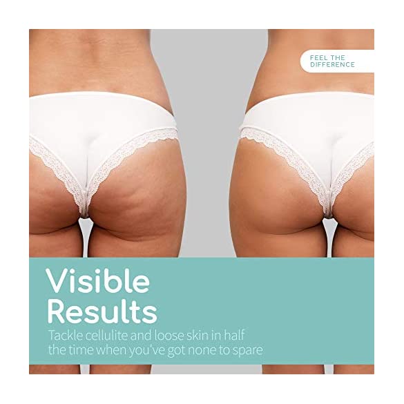 Natural treatments for cellulated buttocks