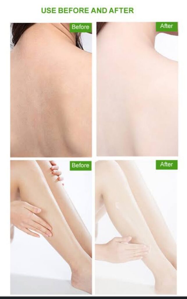 Remedies to lighting the skin