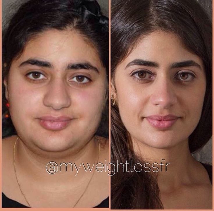 How to lose face fat naturally at home at home with exercise