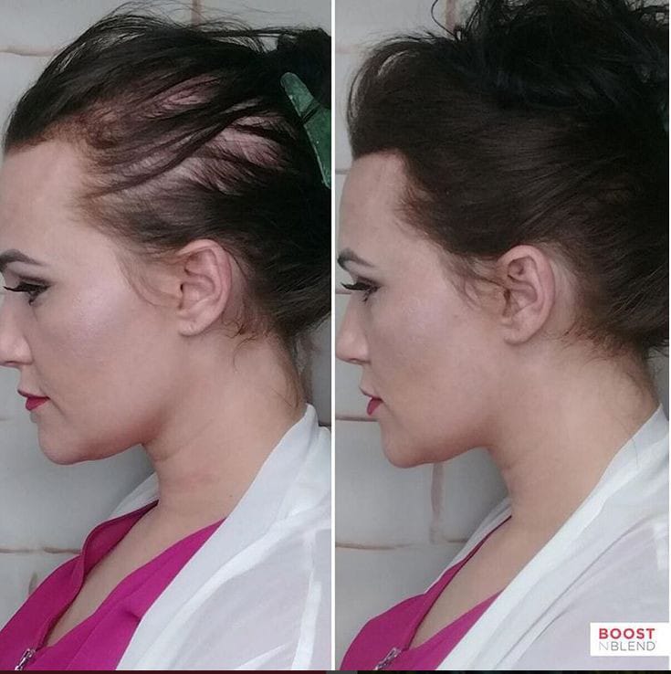Instant hair fall remedies 