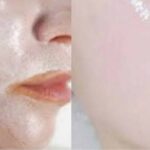 INSTANT SKIN WHITENING HOME REMEDY