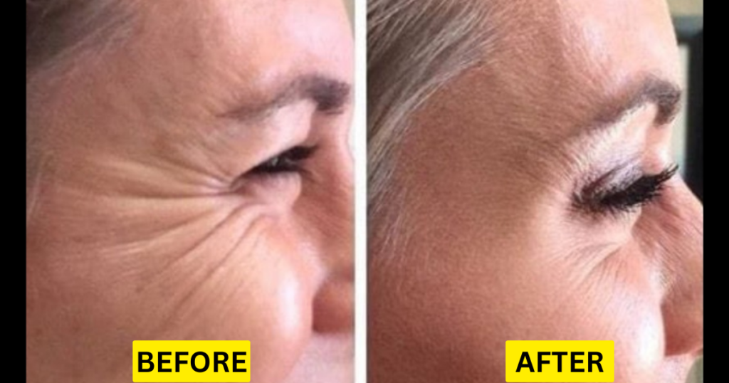 WRINKLE-FREE AND ANTI-AGING SKIN