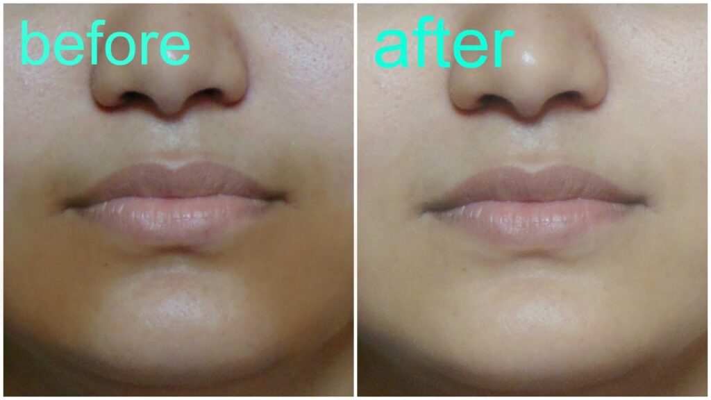 remedies for uneven skin tone