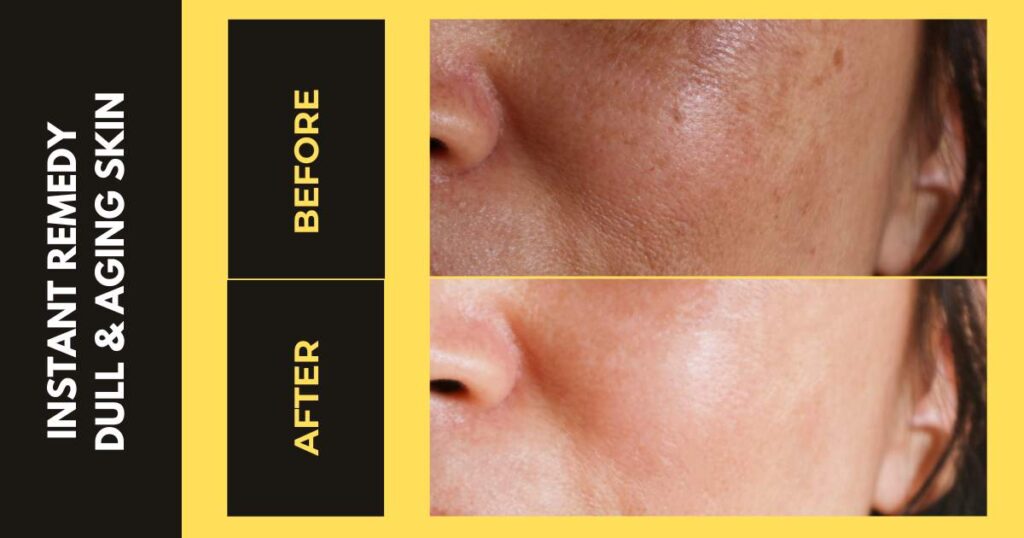 INSTANT REMEDY FOR DULL AND AGING SKIN