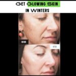 GET GLOWING SKIN IN WINTERS
