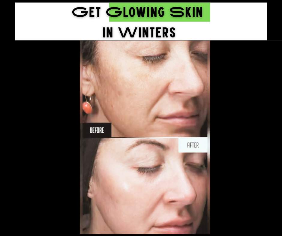 GET GLOWING SKIN IN WINTERS