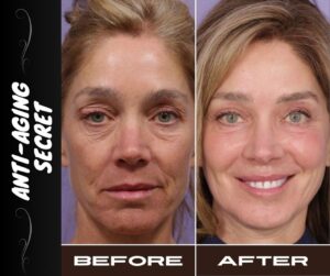 ANTI-AGING SECRET FOR ALL SKIN TYPES