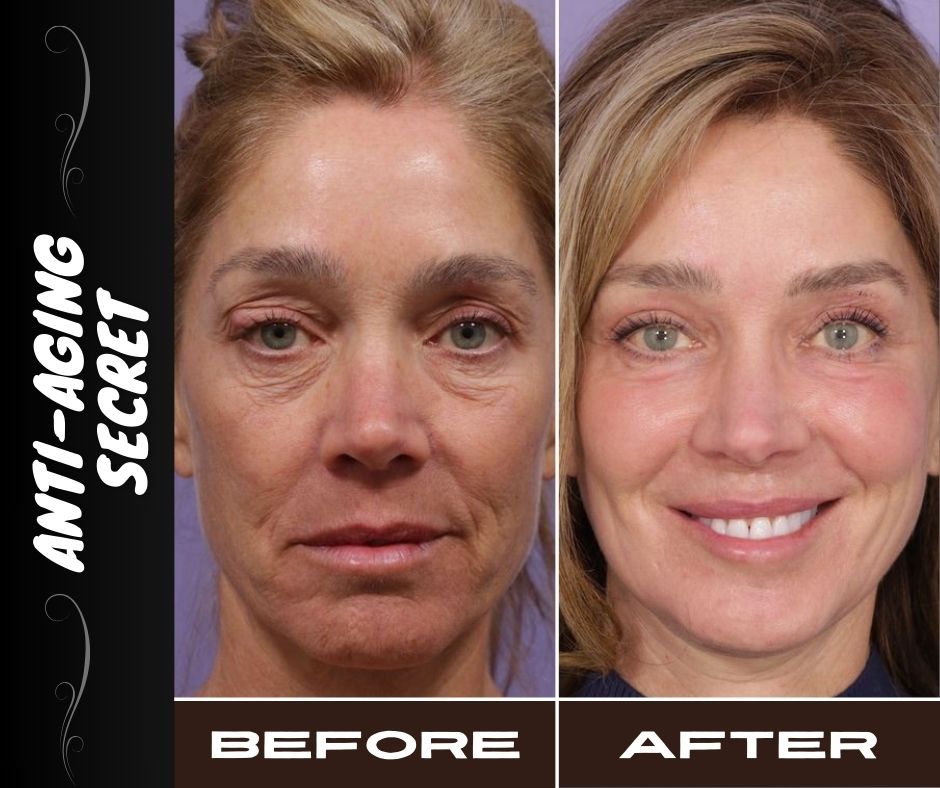ANTI-AGING SECRET FOR ALL SKIN TYPES