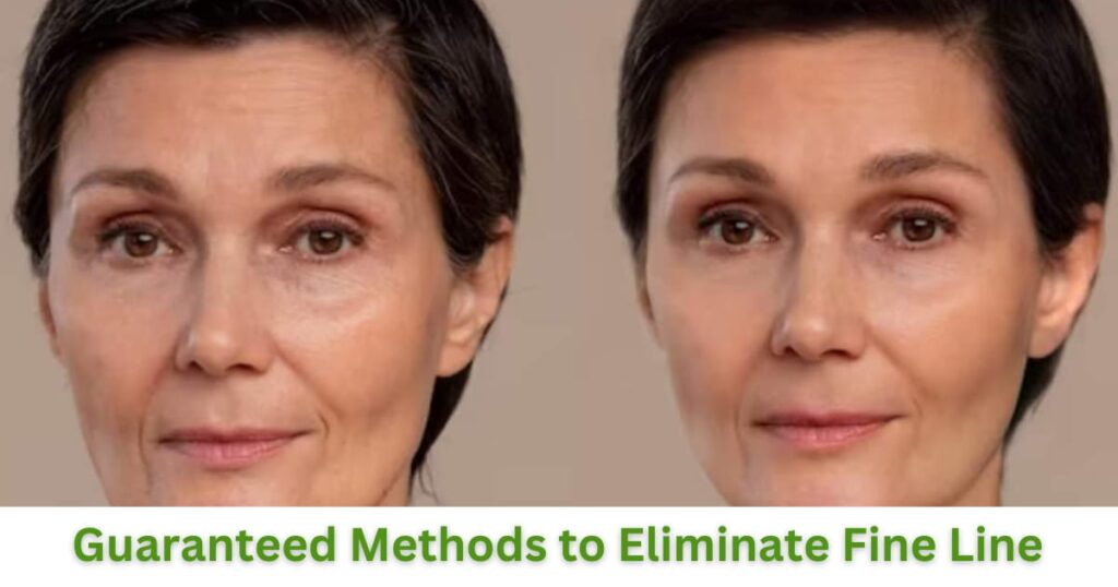 Guaranteed Methods to Eliminate Fine Lines at Home