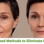 Guaranteed Methods to Eliminate Fine Lines at Home
