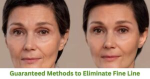 Guaranteed Methods to Eliminate Fine Lines at Home