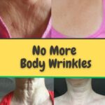 NO MORE BODY WRINKLES WITH NATURAL REMEDY