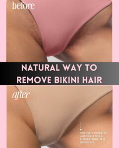 Natural-Ways-to-Remove-Bikini-Hair