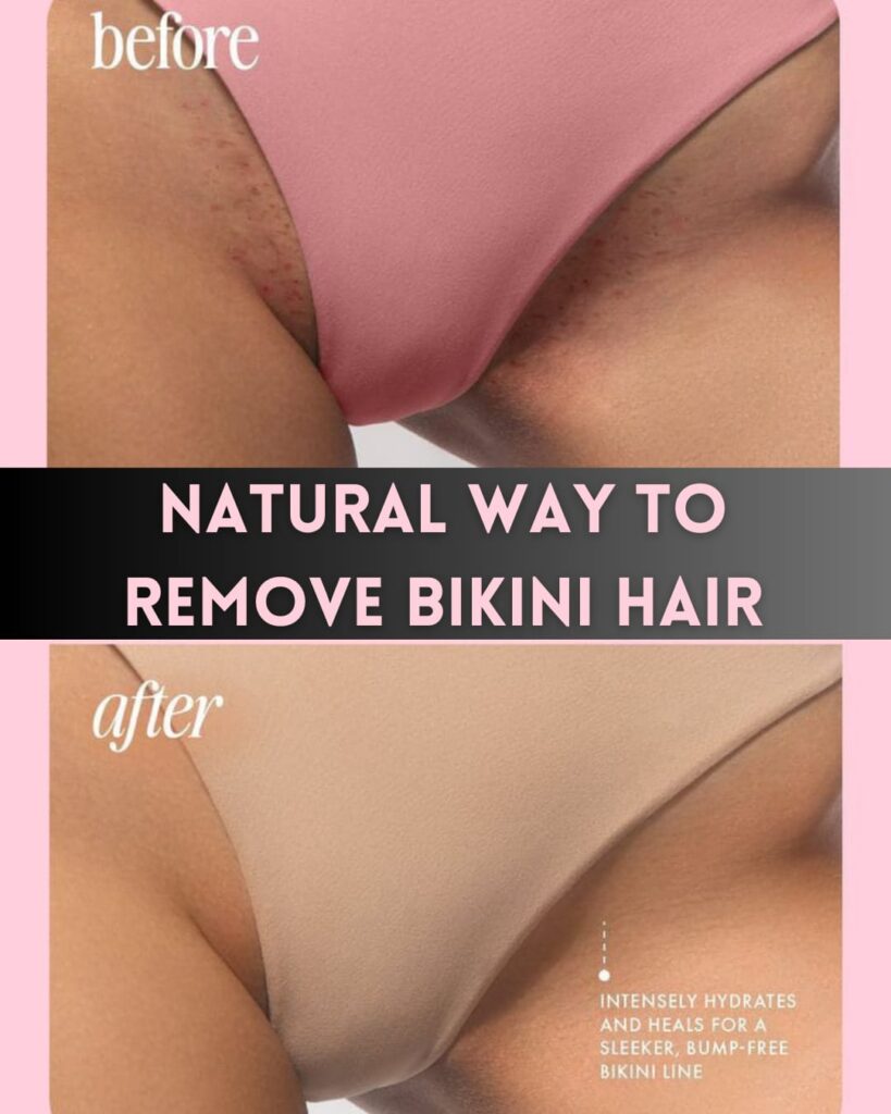 Natural-Ways-to-Remove-Bikini-Hair