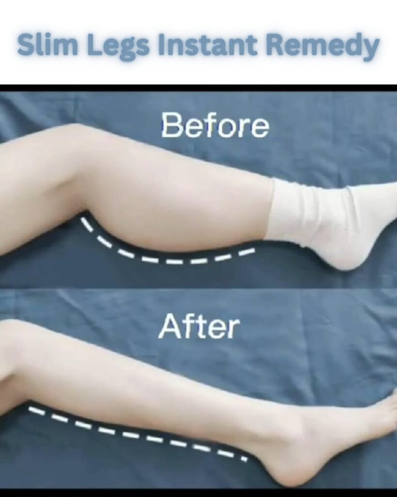 Slim Legs Instantly: 5 Natural Home Remedies