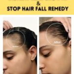 INSTANT HAIR GROWTH & STOP HAIR FALL REMEDY