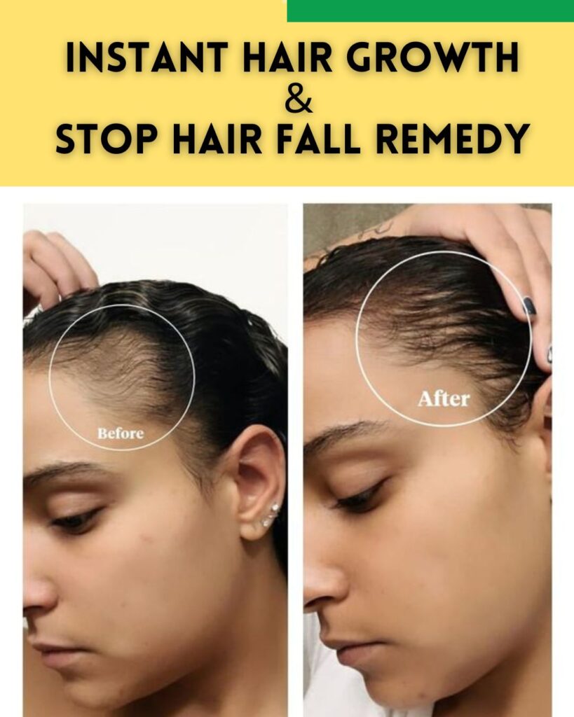 INSTANT HAIR GROWTH & STOP HAIR FALL REMEDY