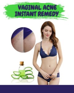 Instant Home Remedies for Vaginal Acne