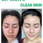 Get Glow and Clear Skin