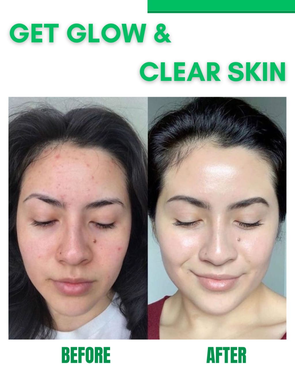 Get Glow and Clear Skin