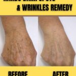 HANDS DARK SPOTS & WRINKLES REMEDY