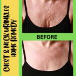 Home Remedies for Neck and Chest Wrinkles