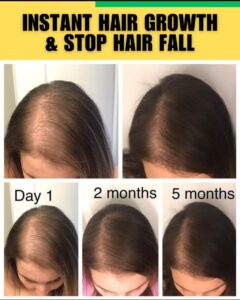INSTANT HAIR GROWTH AND STOP HAIR FALL